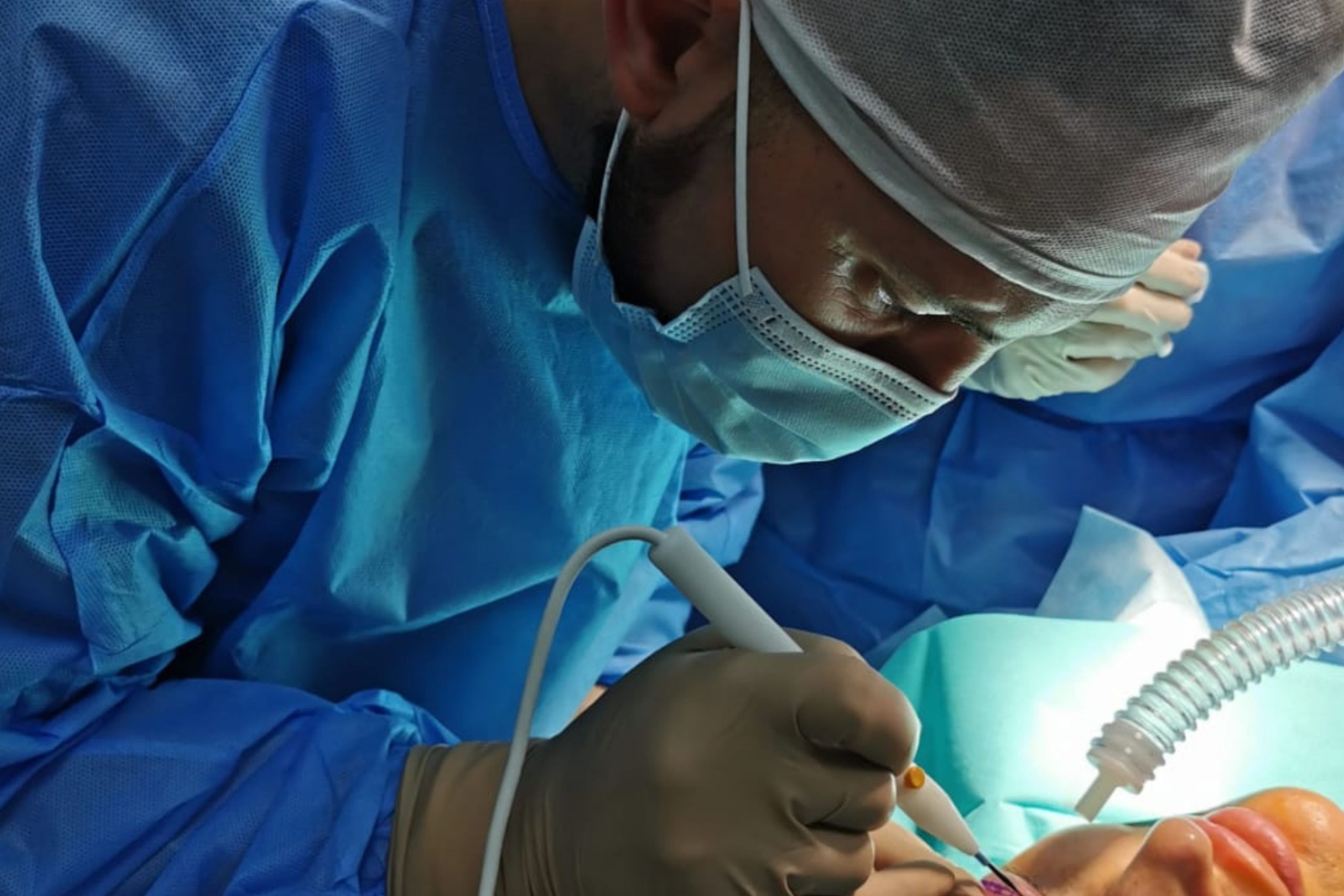 Blefaroplastyka metodą radiochirurgii